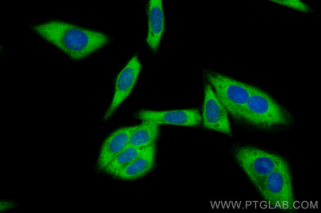 RPS18 Antibody in Immunocytochemistry (ICC/IF)