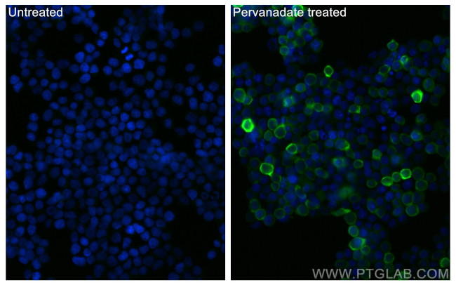 Phospho-SYK (Tyr323) Antibody in Immunocytochemistry (ICC/IF)