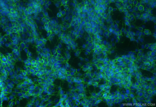 NCAM1/CD56 Antibody in Immunocytochemistry (ICC/IF)