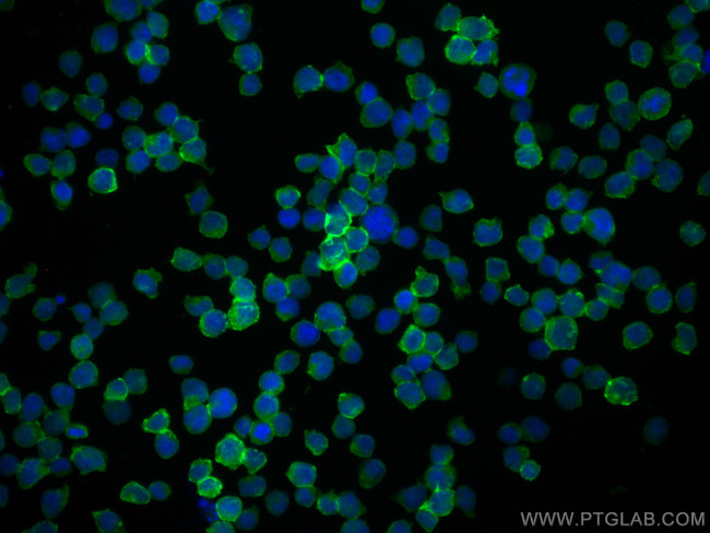 CD28 Antibody in Immunocytochemistry (ICC/IF)
