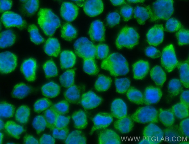 NLRC5 Antibody in Immunocytochemistry (ICC/IF)