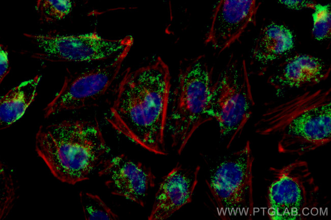 AGXT Antibody in Immunocytochemistry (ICC/IF)