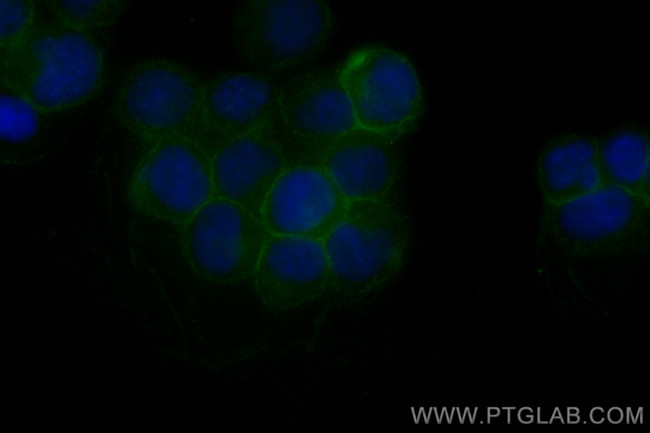 Fas/CD95 Antibody in Immunocytochemistry (ICC/IF)
