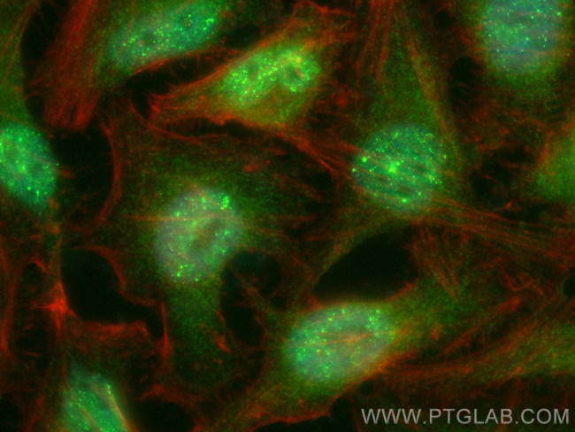 SREBF2 Antibody in Immunocytochemistry (ICC/IF)