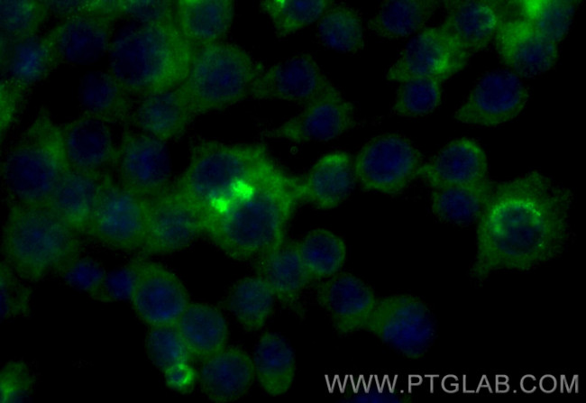 Osteopontin Antibody in Immunocytochemistry (ICC/IF)