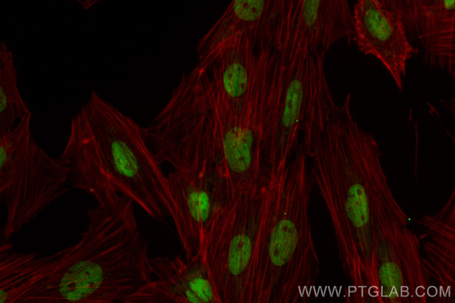 TBX20 Antibody in Immunocytochemistry (ICC/IF)