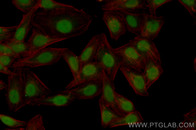 ESR2 Antibody in Immunocytochemistry (ICC/IF)