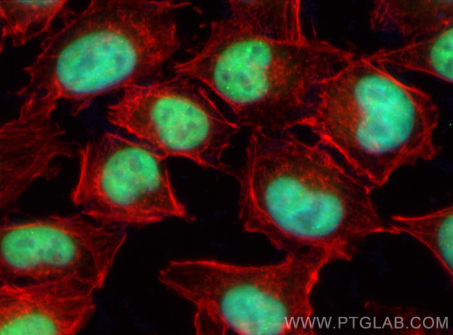 FOXC2 Antibody in Immunocytochemistry (ICC/IF)