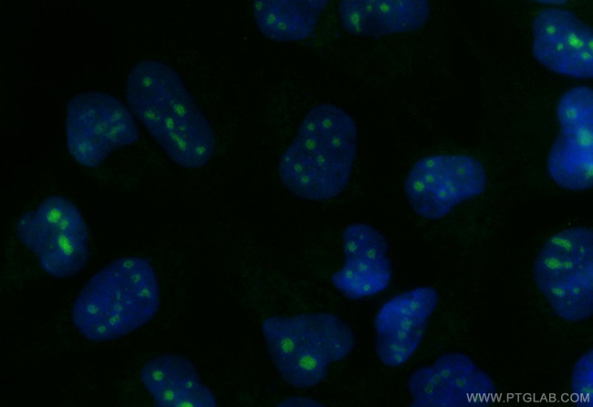 RPP30 Antibody in Immunocytochemistry (ICC/IF)