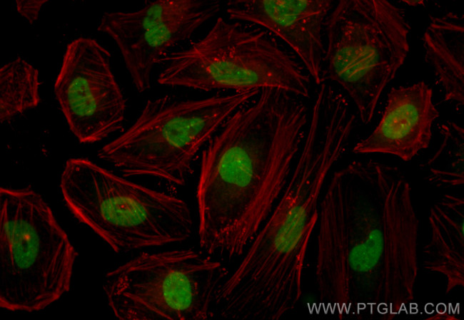 MDC1 Antibody in Immunocytochemistry (ICC/IF)