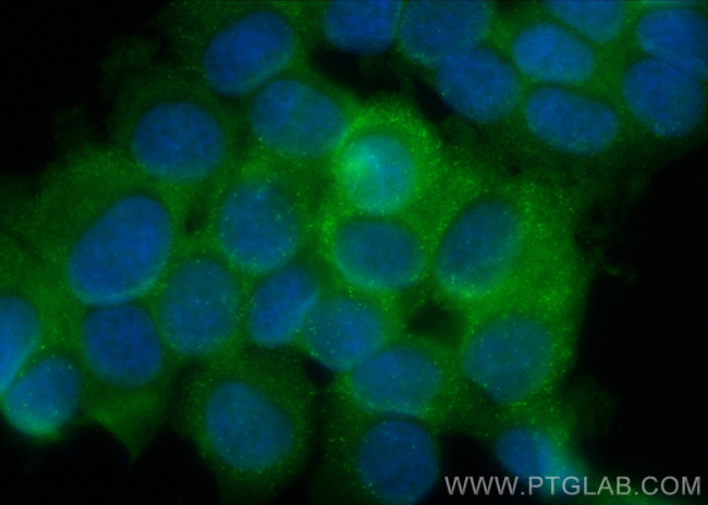 HARS Antibody in Immunocytochemistry (ICC/IF)