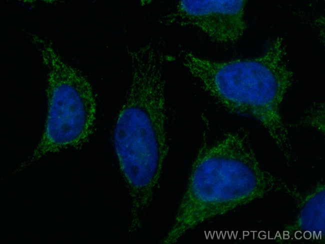 MRPL40 Antibody in Immunocytochemistry (ICC/IF)