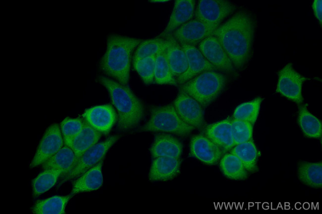 RPS11 Antibody in Immunocytochemistry (ICC/IF)
