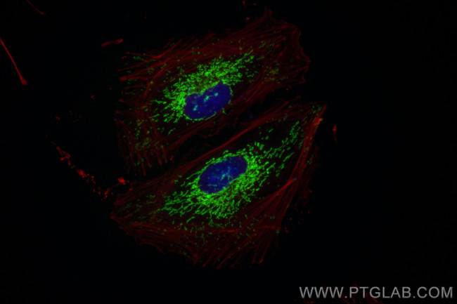 SOD2 Antibody in Immunocytochemistry (ICC/IF)