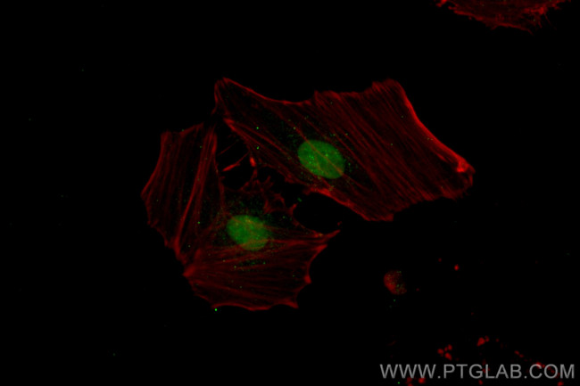 PSMD1 Antibody in Immunocytochemistry (ICC/IF)