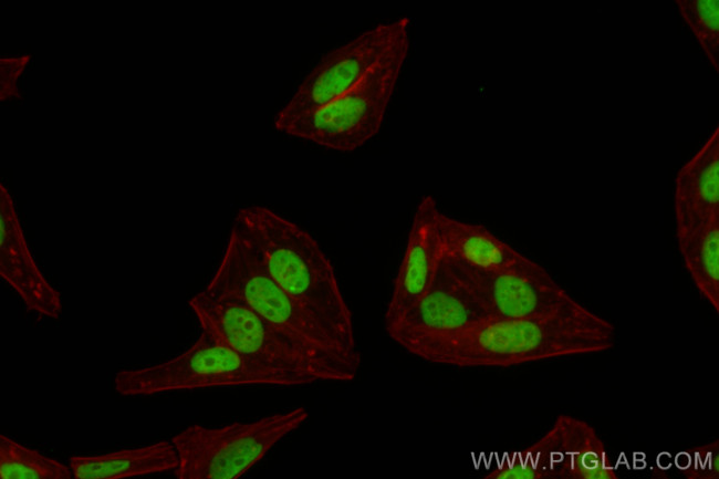 MED12L Antibody in Immunocytochemistry (ICC/IF)