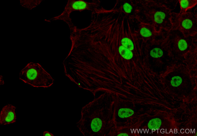 TMEM53 Antibody in Immunocytochemistry (ICC/IF)