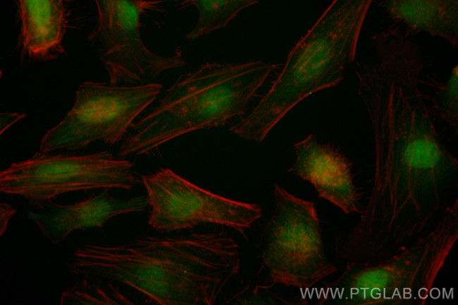 ANAPC10 Antibody in Immunocytochemistry (ICC/IF)