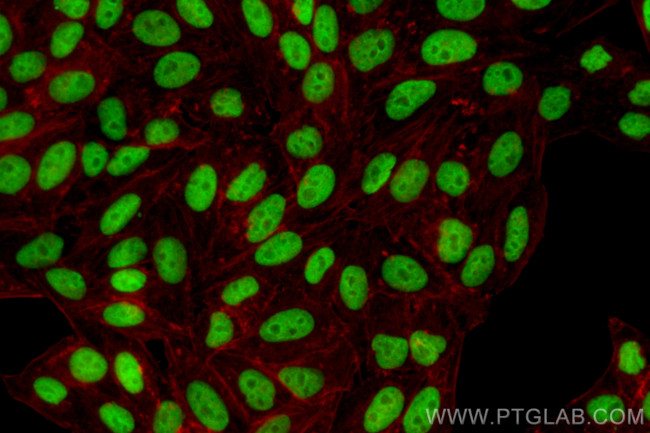 GAR1 Antibody in Immunocytochemistry (ICC/IF)