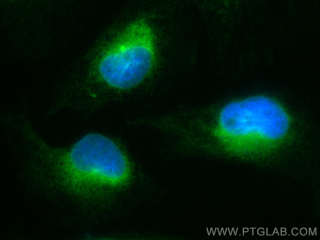 GPSN2 Antibody in Immunocytochemistry (ICC/IF)