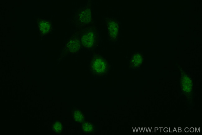 KMT2C Antibody in Immunocytochemistry (ICC/IF)