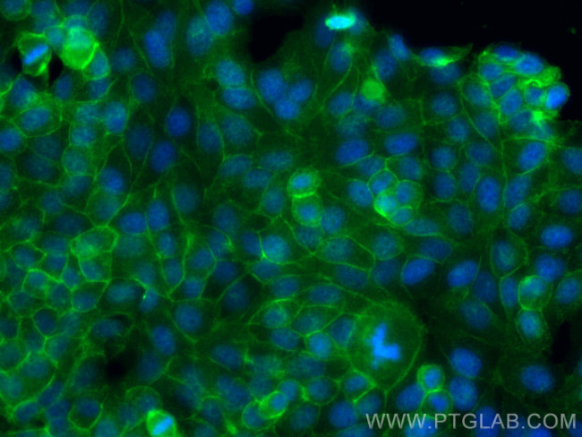 Dystrophin Antibody in Immunocytochemistry (ICC/IF)
