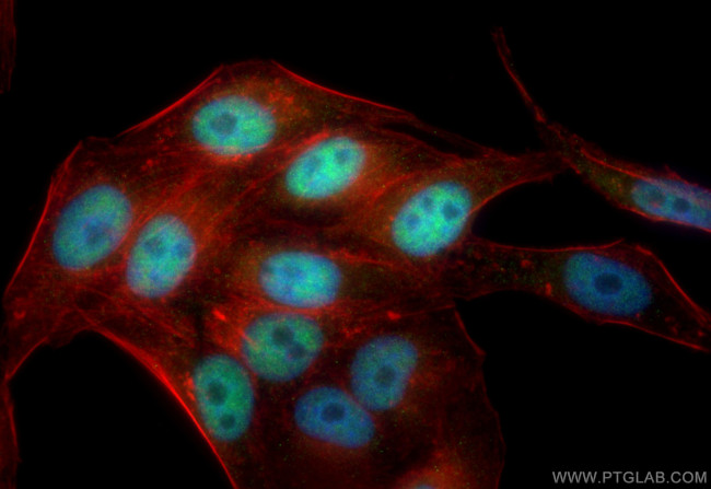 ZBTB7A Antibody in Immunocytochemistry (ICC/IF)