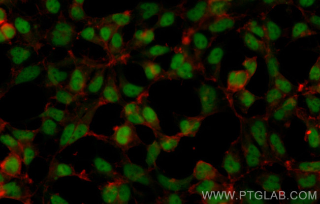 C1orf83 Antibody in Immunocytochemistry (ICC/IF)