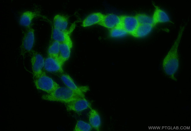 Synaptotagmin-1 Antibody in Immunocytochemistry (ICC/IF)