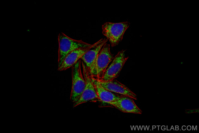 DLAT Antibody in Immunocytochemistry (ICC/IF)