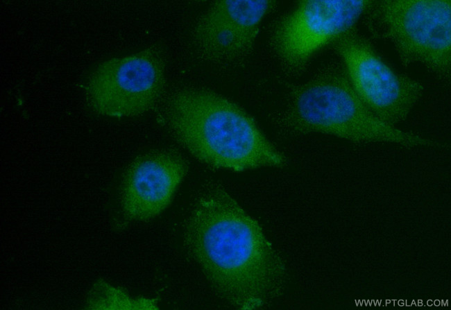 LPXN Antibody in Immunocytochemistry (ICC/IF)