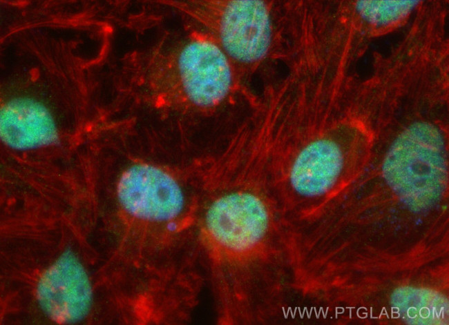 CDK9 Antibody in Immunocytochemistry (ICC/IF)