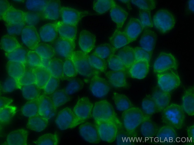 CHI3L1/YKL40 Antibody in Immunocytochemistry (ICC/IF)