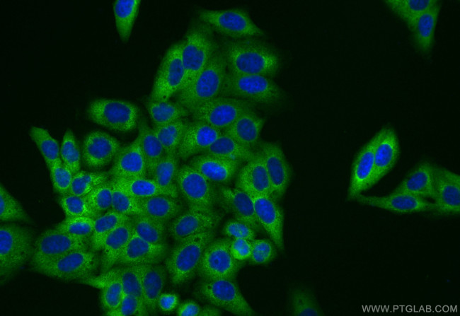 MARS Antibody in Immunocytochemistry (ICC/IF)