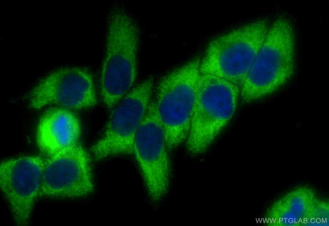 LRRC47 Antibody in Immunocytochemistry (ICC/IF)