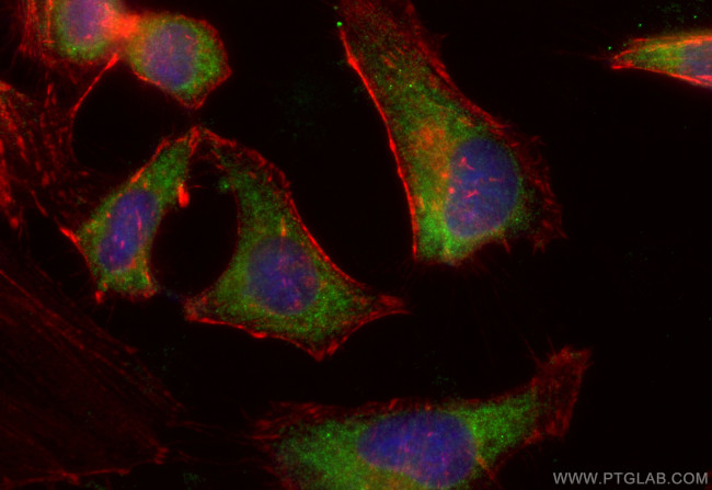 MTMR9 Antibody in Immunocytochemistry (ICC/IF)