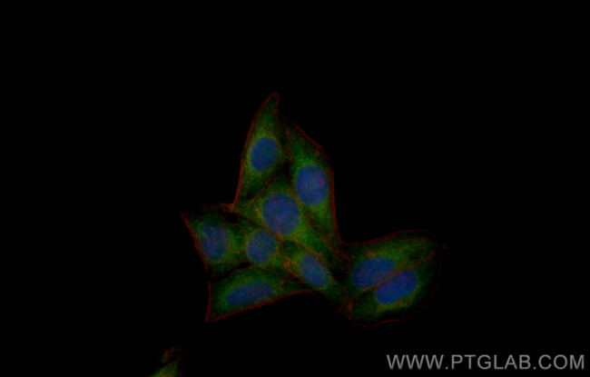 Beta galactosidase Antibody in Immunocytochemistry (ICC/IF)