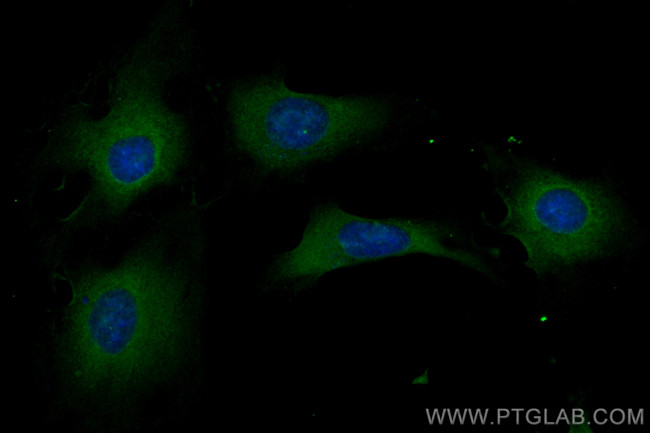 RAP1A Antibody in Immunocytochemistry (ICC/IF)
