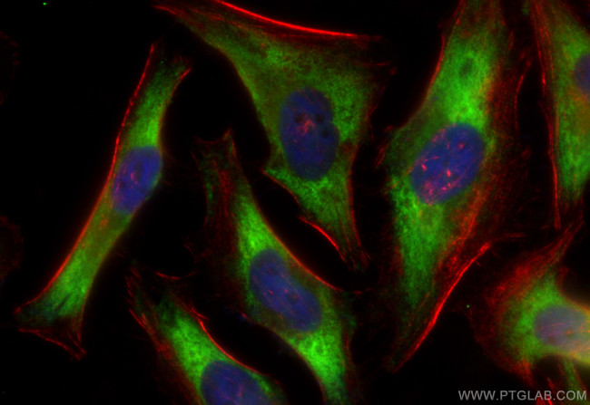 Bif-1 Antibody in Immunocytochemistry (ICC/IF)