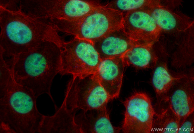 FOXK2 Antibody in Immunocytochemistry (ICC/IF)