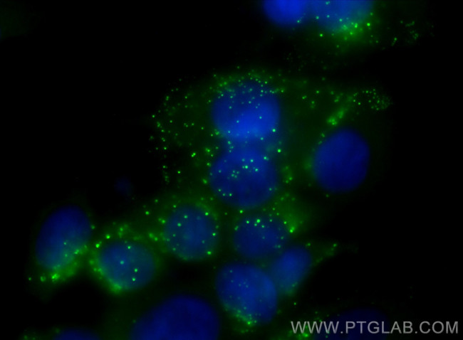Cathepsin D Antibody in Immunocytochemistry (ICC/IF)