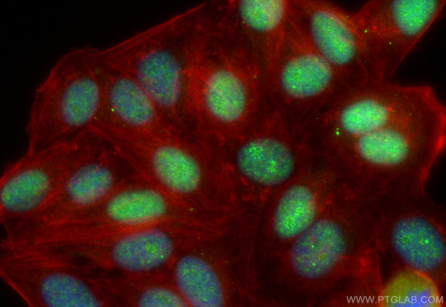 TDG Antibody in Immunocytochemistry (ICC/IF)