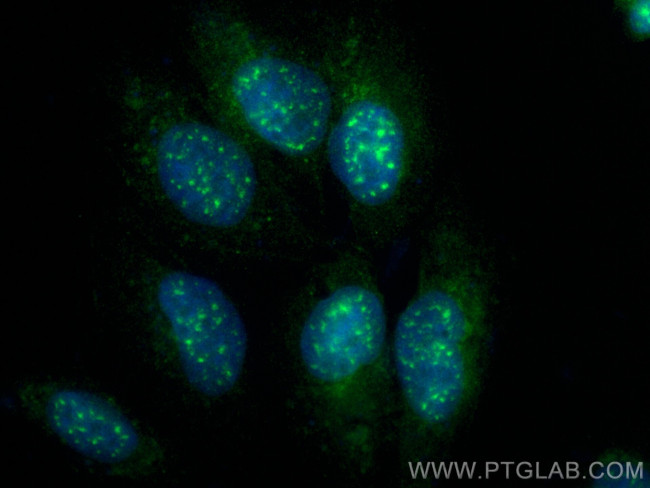 SON Antibody in Immunocytochemistry (ICC/IF)
