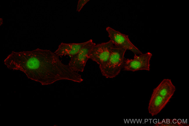 CSNK2A1 Antibody in Immunocytochemistry (ICC/IF)