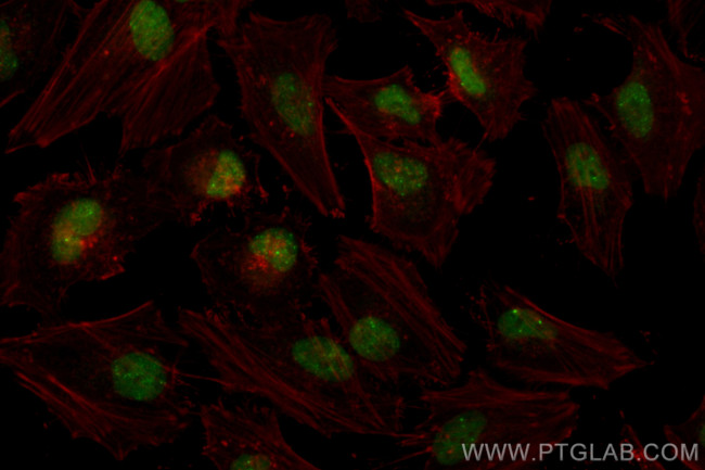 TP53BP1 Antibody in Immunocytochemistry (ICC/IF)