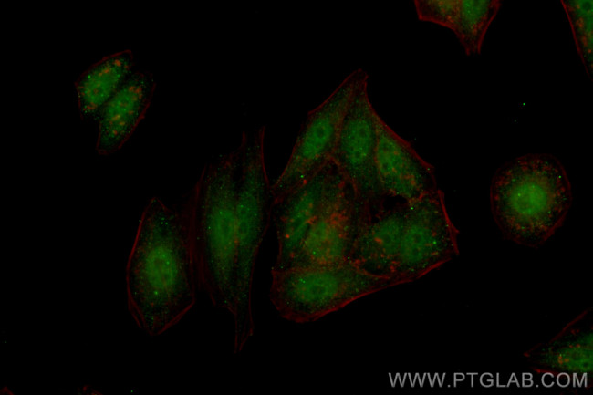 SMAD2 Antibody in Immunocytochemistry (ICC/IF)