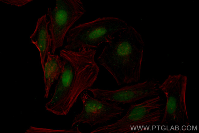 TRMT6 Antibody in Immunocytochemistry (ICC/IF)