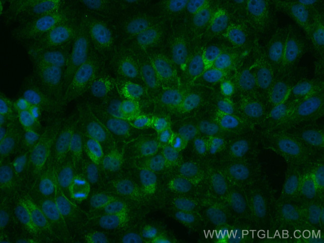 SLC31A1 Antibody in Immunocytochemistry (ICC/IF)