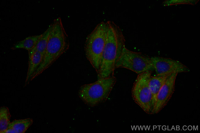 FAM127B Antibody in Immunocytochemistry (ICC/IF)