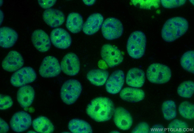 FIP1L1 Antibody in Immunocytochemistry (ICC/IF)